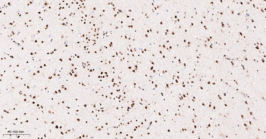 14 - RBBP4 Recombinant Rabbit mAb AP94487