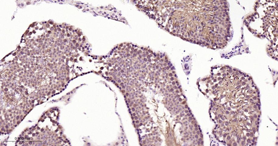 14 - DYNLL1 Recombinant Rabbit mAb AP94490