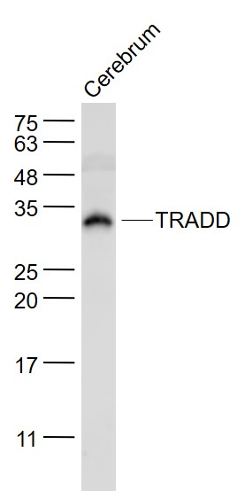 1 - TRADD Rabbit pAb AP94504