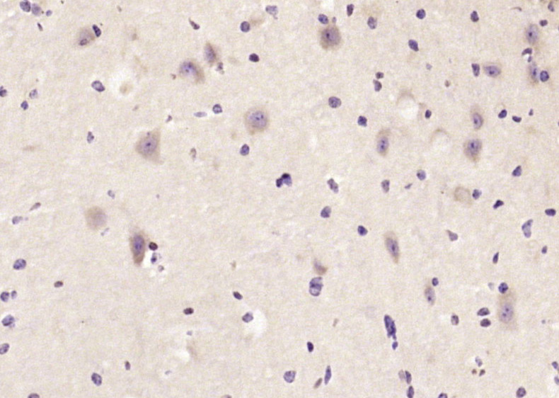 14 - TACC1 Rabbit pAb AP94505