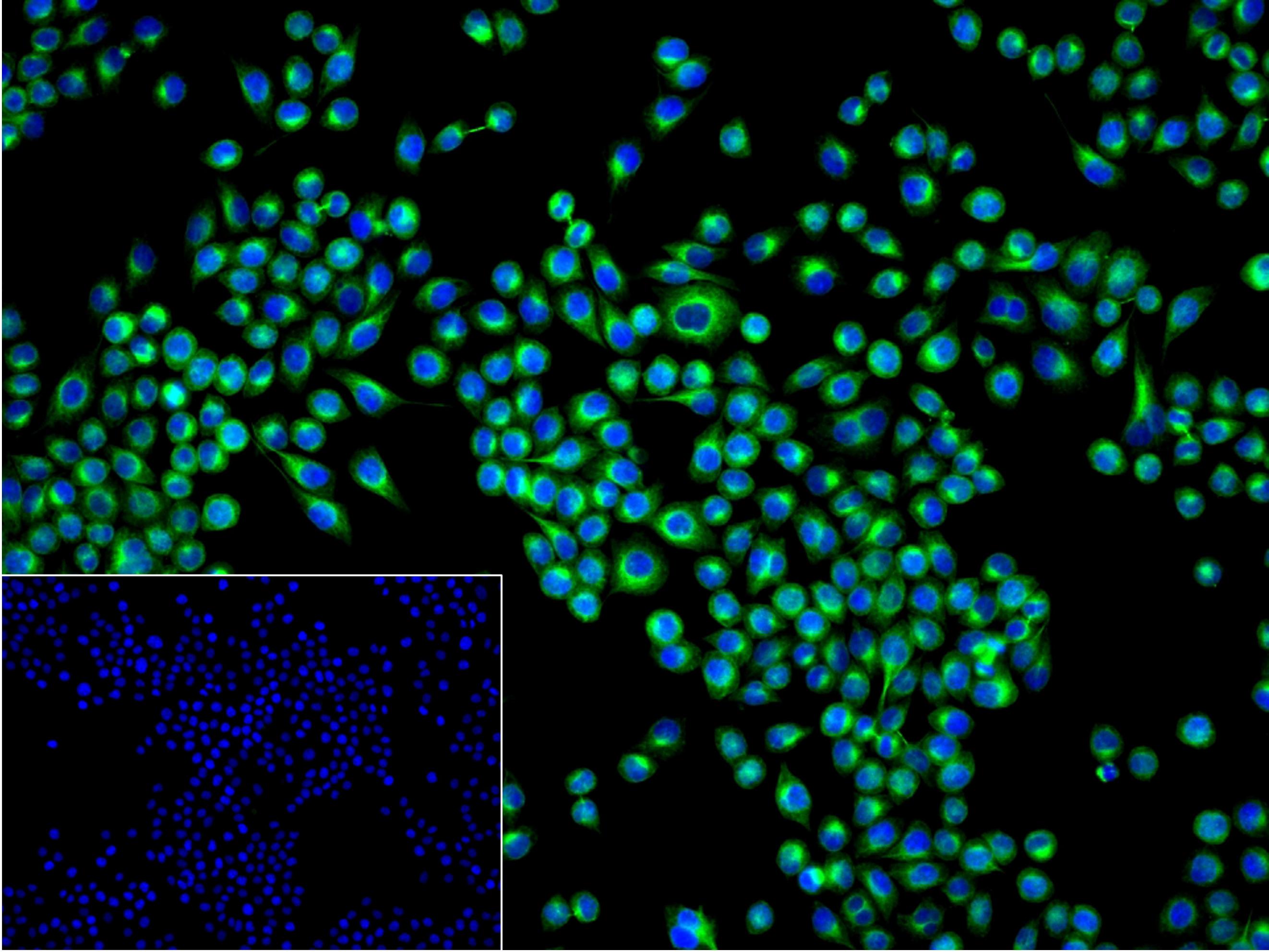 0 - BAP31 Recombinant Rabbit mAb AP94518
