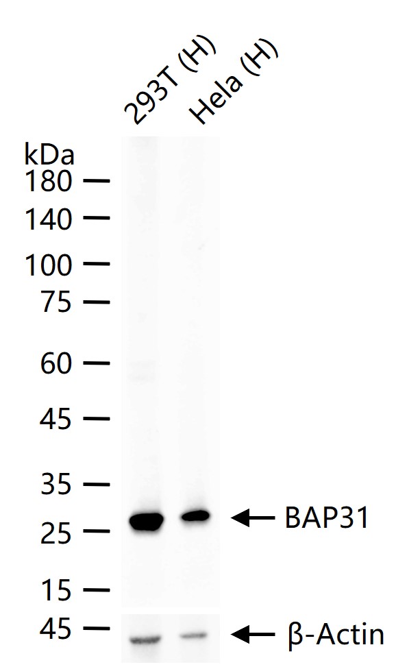 1 - BAP31 Recombinant Rabbit mAb AP94518
