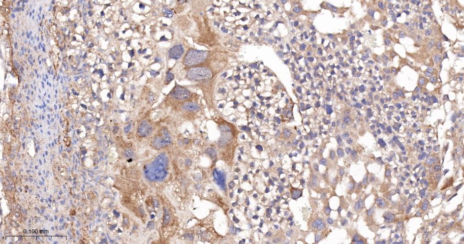 14 - BAP31 Recombinant Rabbit mAb AP94518