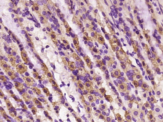 14 - phospho-ALOX5 (Ser271) Rabbit pAb AP94529