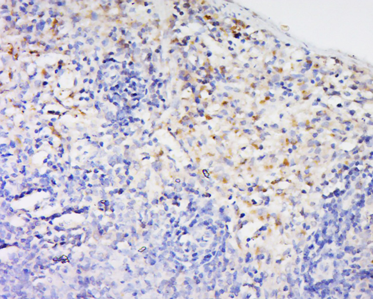14 - Bcl2A1 Rabbit pAb AP94532