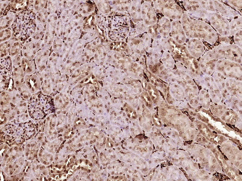 14 - BCSC1 Rabbit pAb AP94533