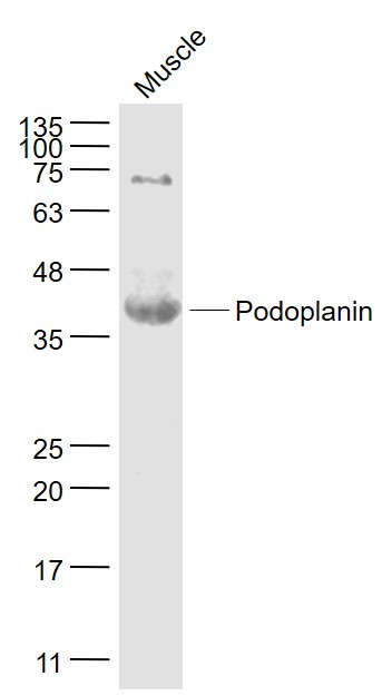 1 - Podoplanin Rabbit pAb AP94535