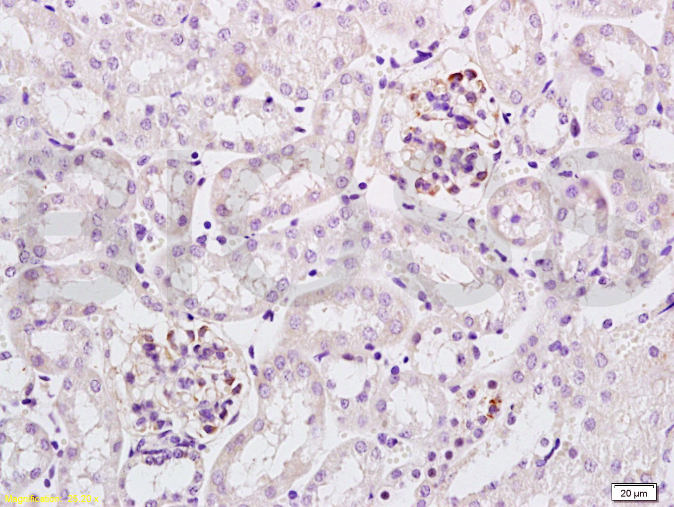 14 - Podoplanin Rabbit pAb AP94535