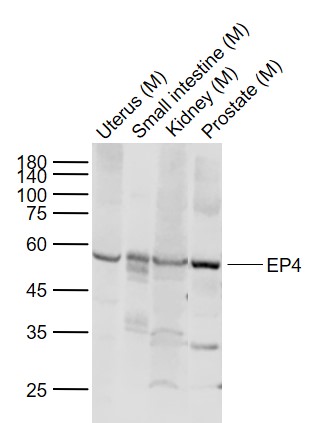 1 - EP4 Rabbit pAb AP94536
