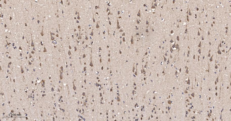 14 - Eef1g Recombinant Rabbit mAb AP94551