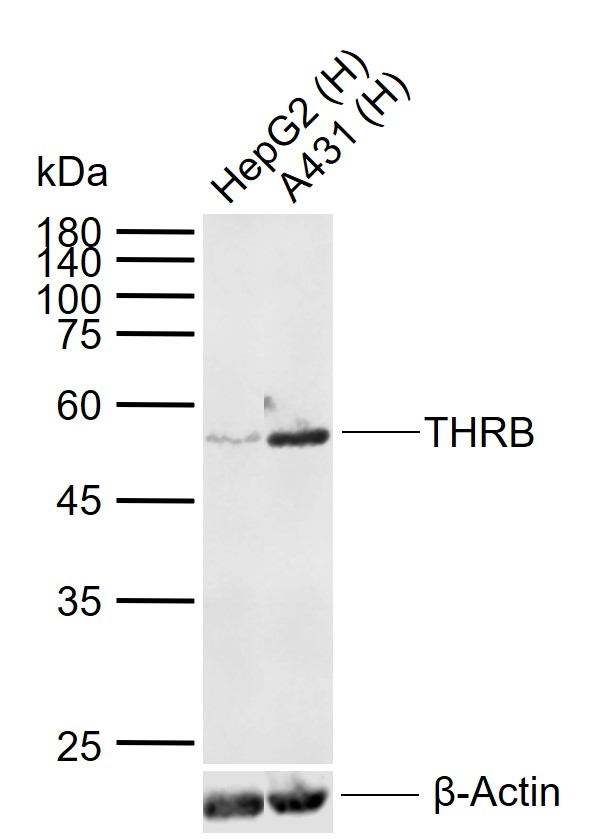 1 - THRB Mouse mAb AP94556