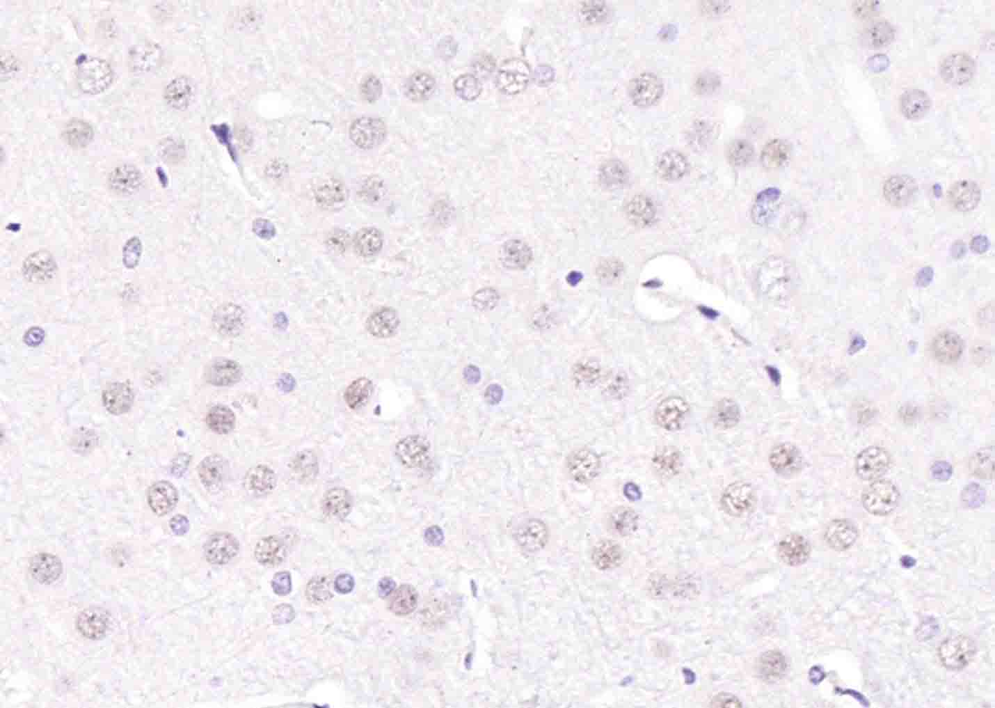 14 - THRB Mouse mAb AP94556