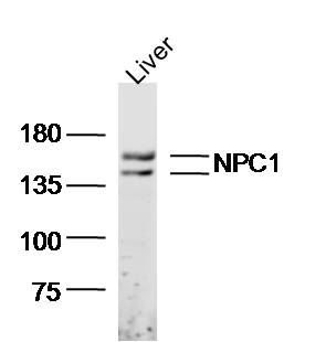 1 - NPC1 Rabbit pAb AP94557
