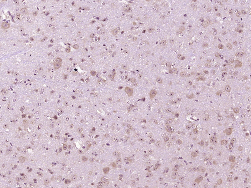 14 - NPC1 Rabbit pAb AP94557
