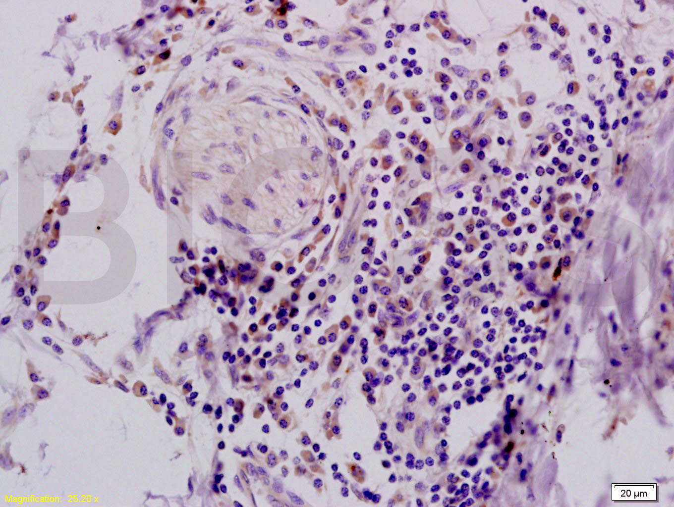 14 - intestinal FABP Rabbit pAb AP94560