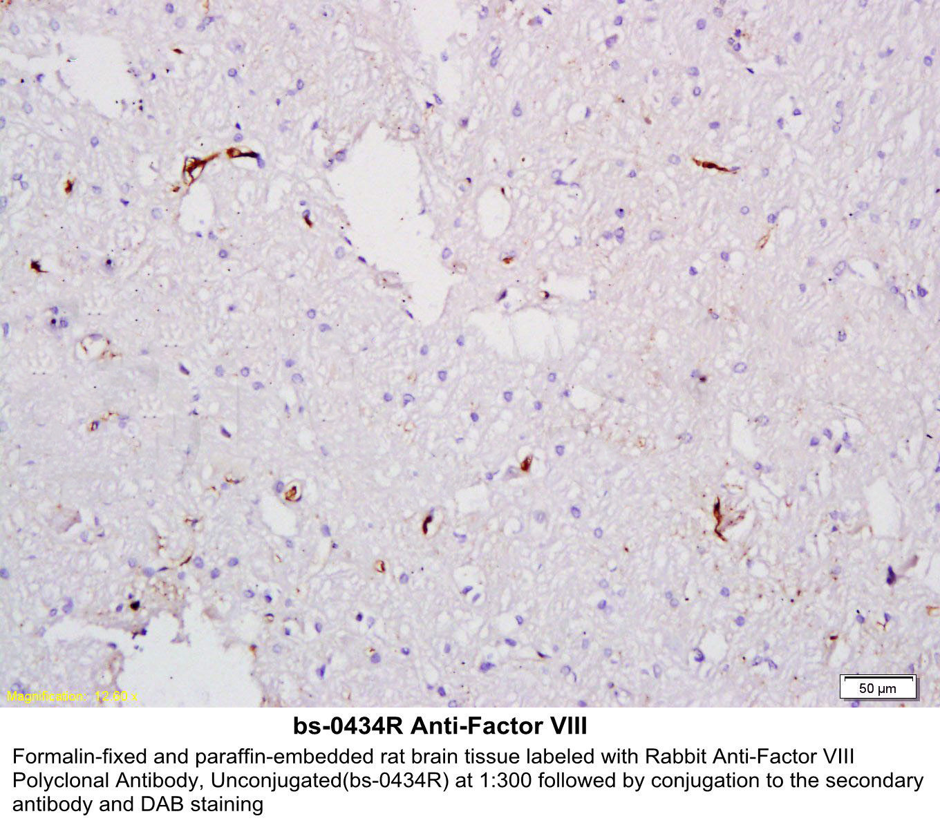 14 - factor VIII Rabbit pAb AP94561