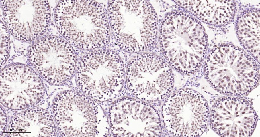 14 - SF1 Recombinant Rabbit mAb AP94580