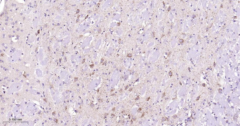 14 - HSPE1 Recombinant Rabbit mAb AP94584