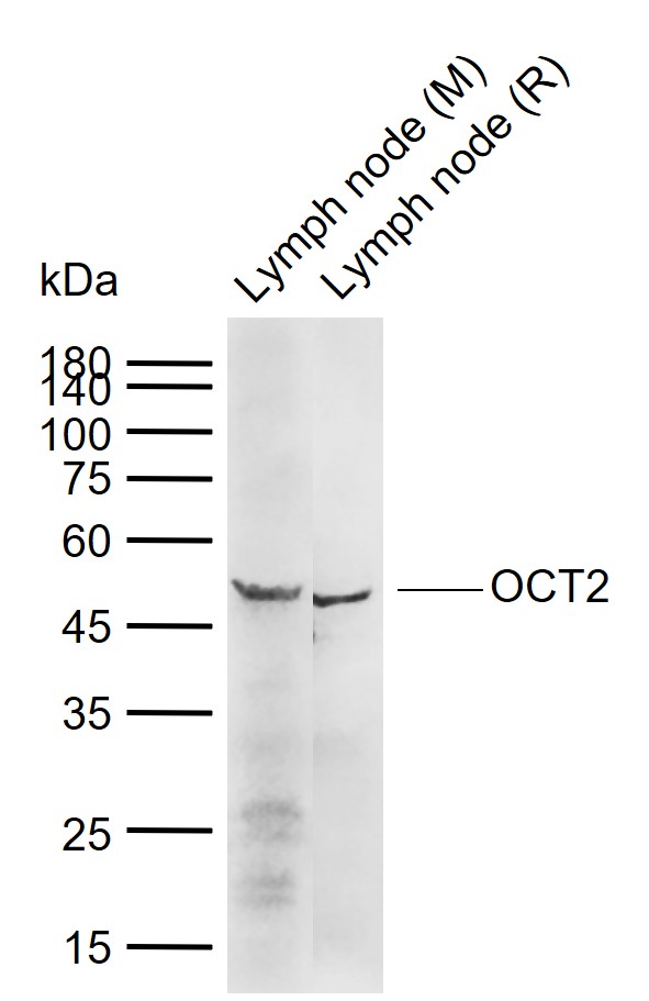 1 - OCT2 Rabbit pAb AP94593