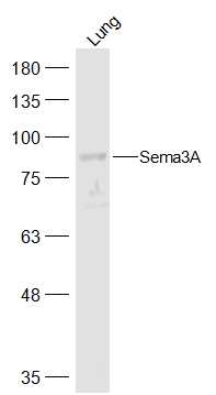1 - Sema3A Rabbit pAb AP94595