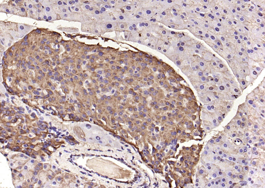 14 - C22orf32 Rabbit pAb AP94597