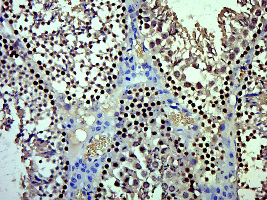 14 - CENPQ Rabbit pAb AP94598