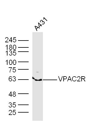1 - VIPR2 Rabbit pAb AP94599