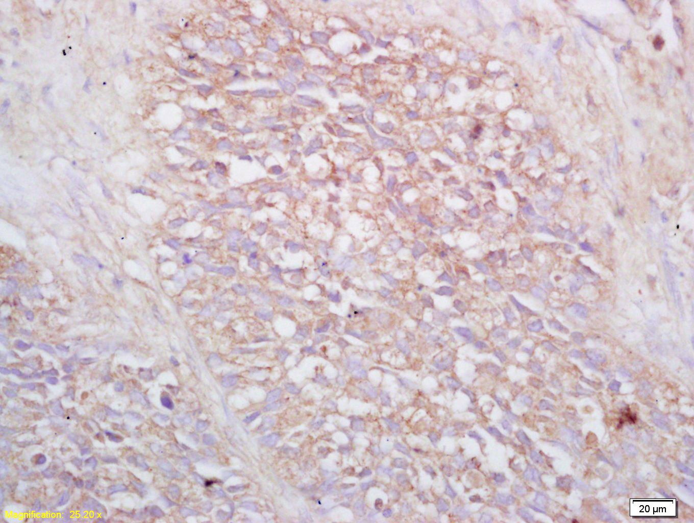 14 - VIPR2 Rabbit pAb AP94599