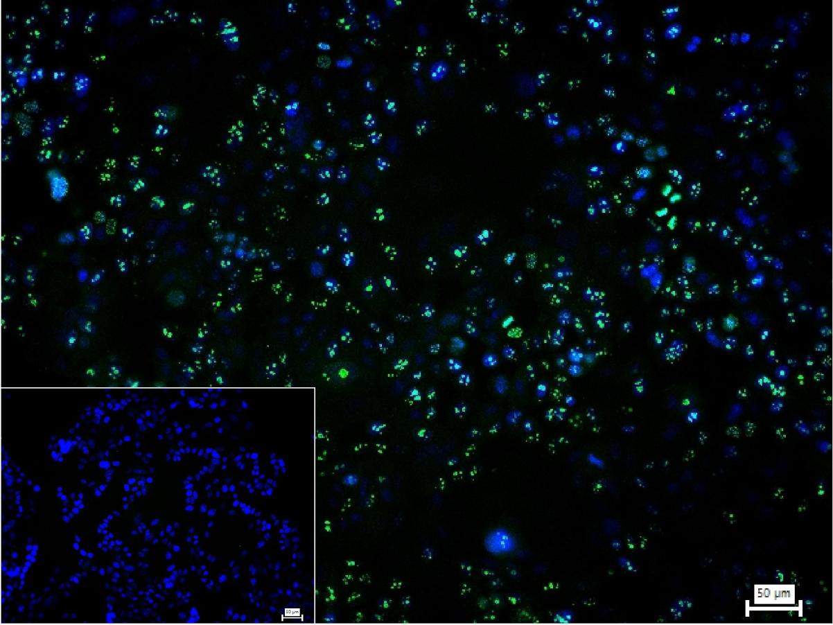 0 - PAX9 Recombinant Rabbit mAb AP94607