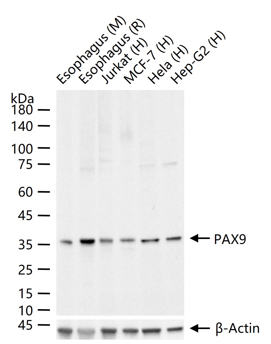 1 - PAX9 Recombinant Rabbit mAb AP94607