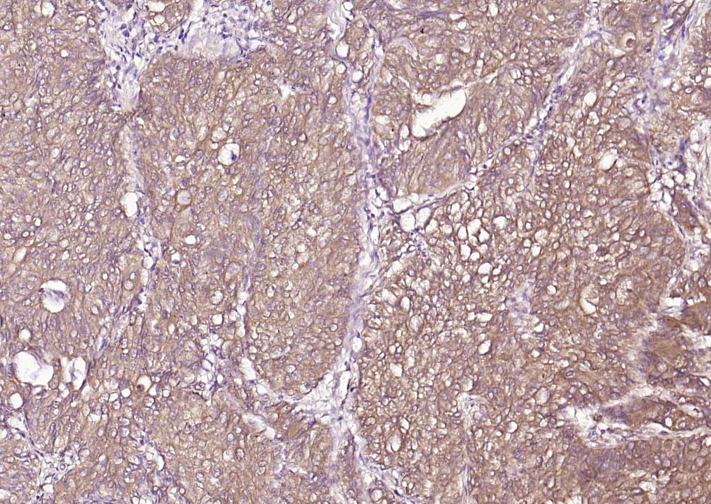 14 - P4HB Recombinant Mouse mAb AP94616