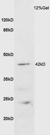 1 - GALR2 Rabbit pAb AP94623