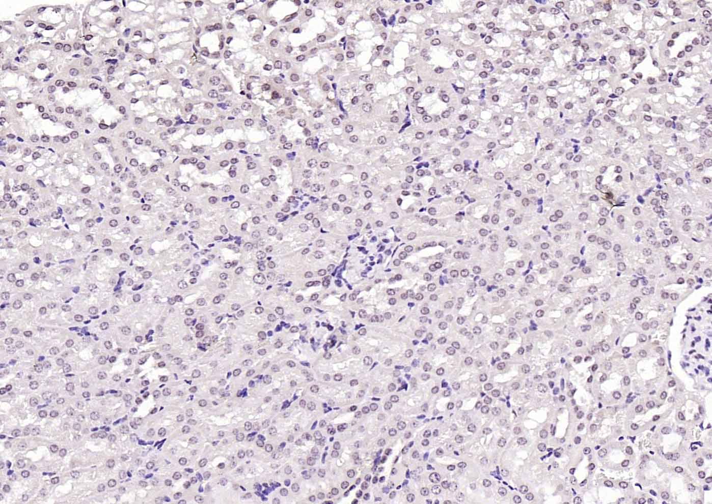 14 - HMGB1 Rabbit pAb AP94624