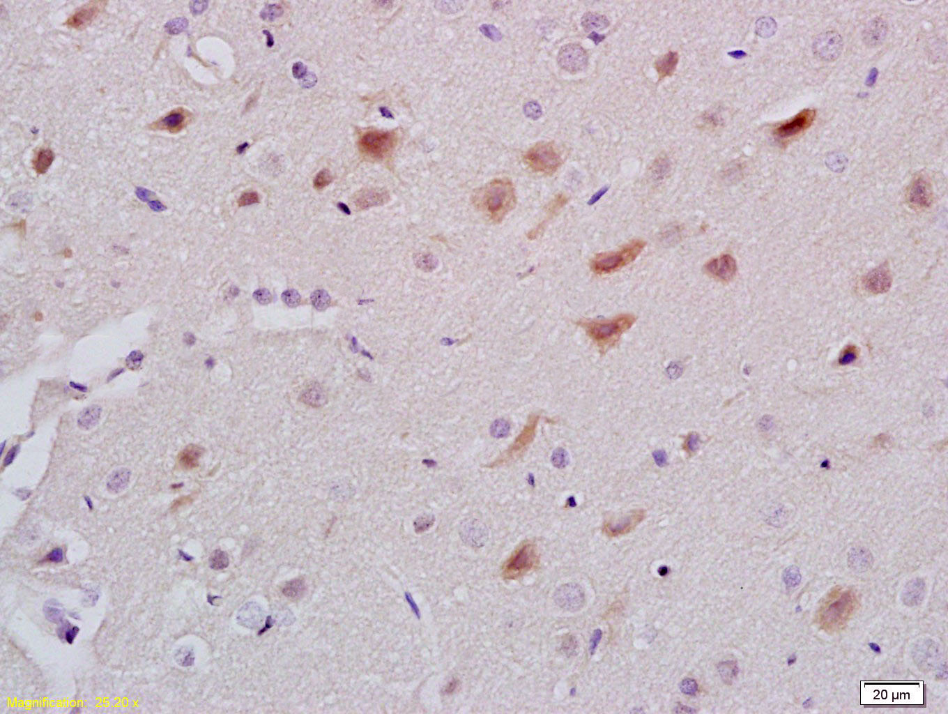 14 - 5-HT Rabbit pAb AP94629