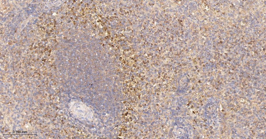 14 - ST13 Recombinant Rabbit mAb AP94635
