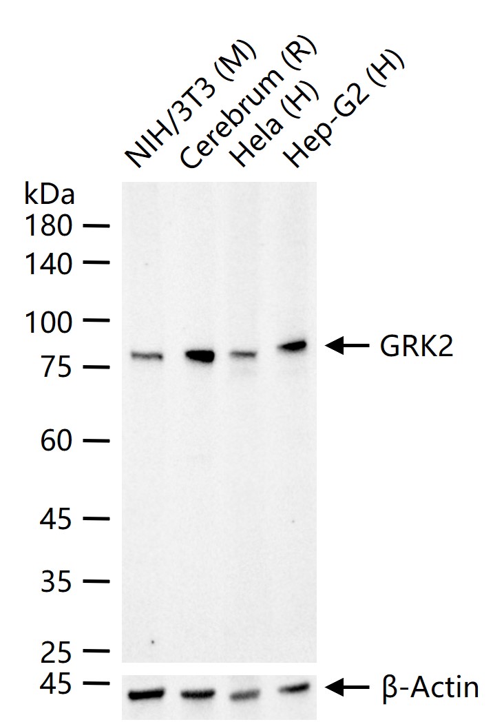 1 - GRK2 Recombinant Rabbit mAb AP94636