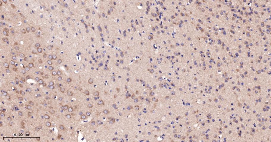 14 - GRK2 Recombinant Rabbit mAb AP94636