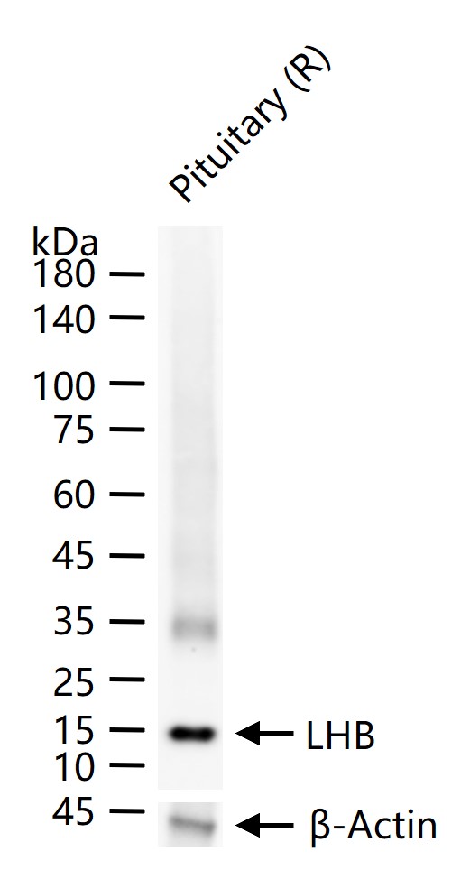 1 - LHB Recombinant Rabbit mAb AP94638