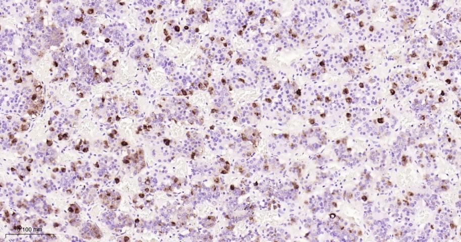 14 - LHB Recombinant Rabbit mAb AP94638