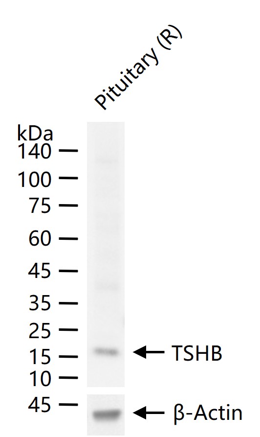 1 - TSHB Recombinant Rabbit mAb AP94642