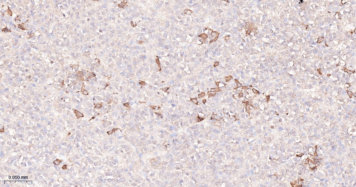 14 - TSHB Recombinant Rabbit mAb AP94642