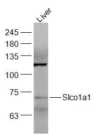 1 - Slco1a1 Rabbit pAb AP94652