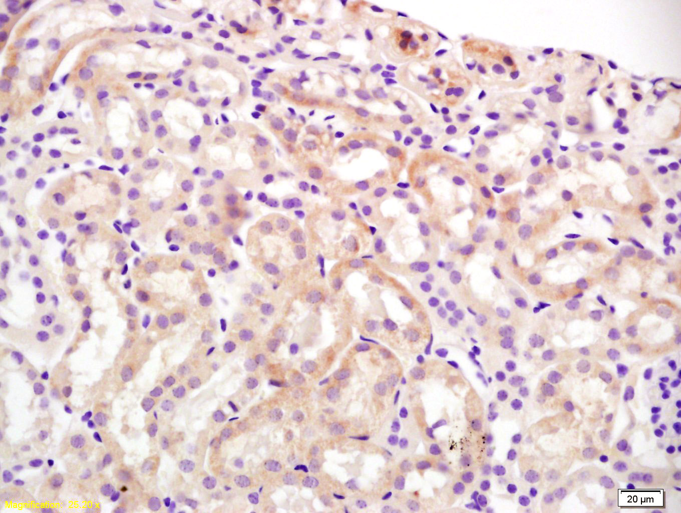 14 - Slco1a1 Rabbit pAb AP94652