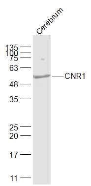 1 - CNR1 Rabbit pAb AP94653