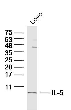 1 - IL-5 Rabbit pAb AP94654