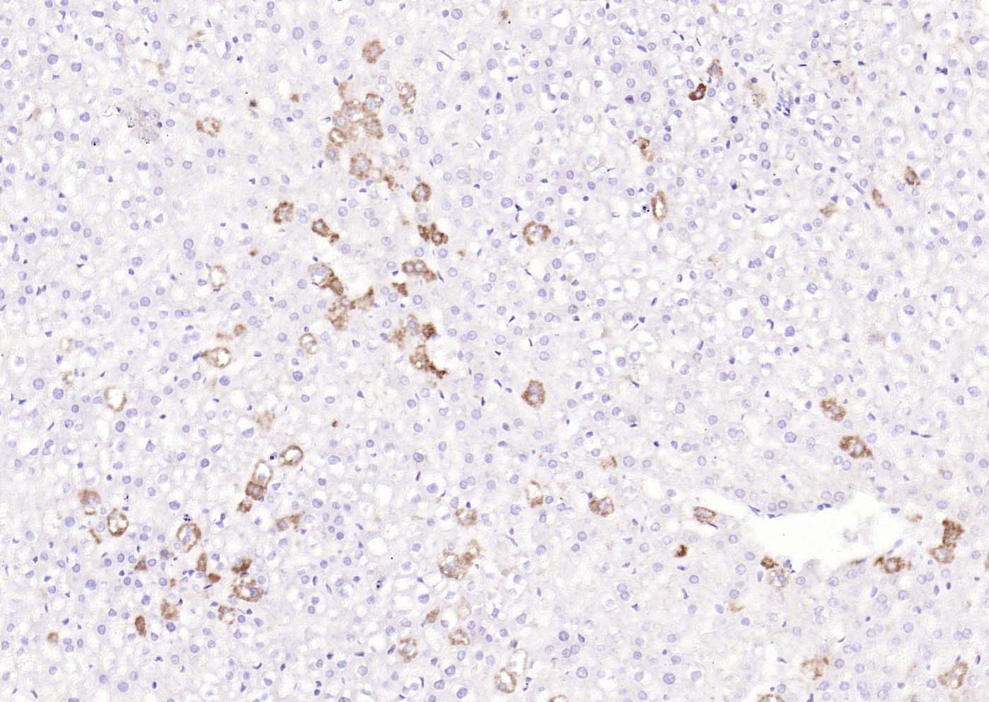 14 - IL-5 Rabbit pAb AP94654