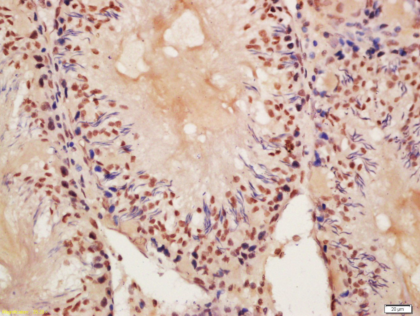14 - PROCA1 Rabbit pAb AP94655