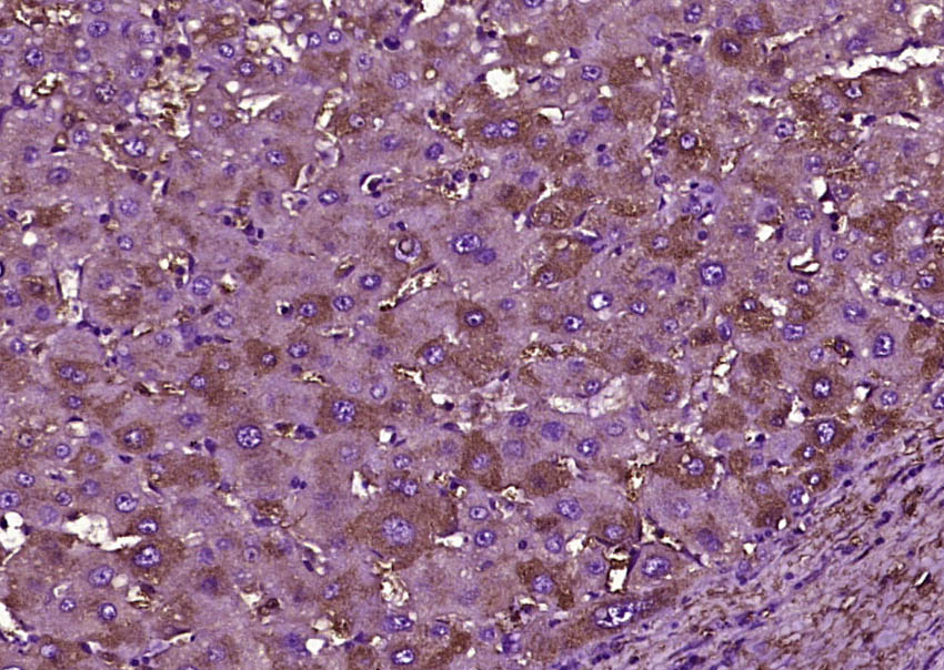 14 - High density lipoprotein Rabbit pAb AP94656