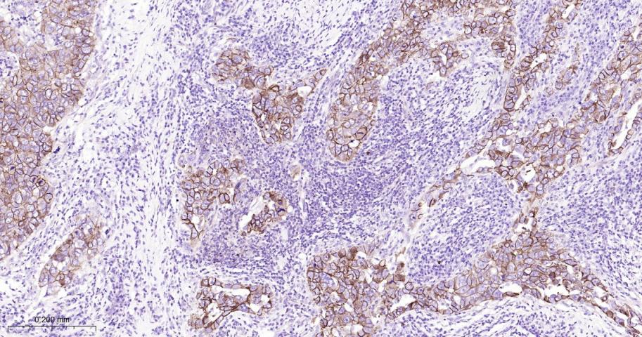 14 - CTNND1 Recombinant Rabbit mAb AP94676