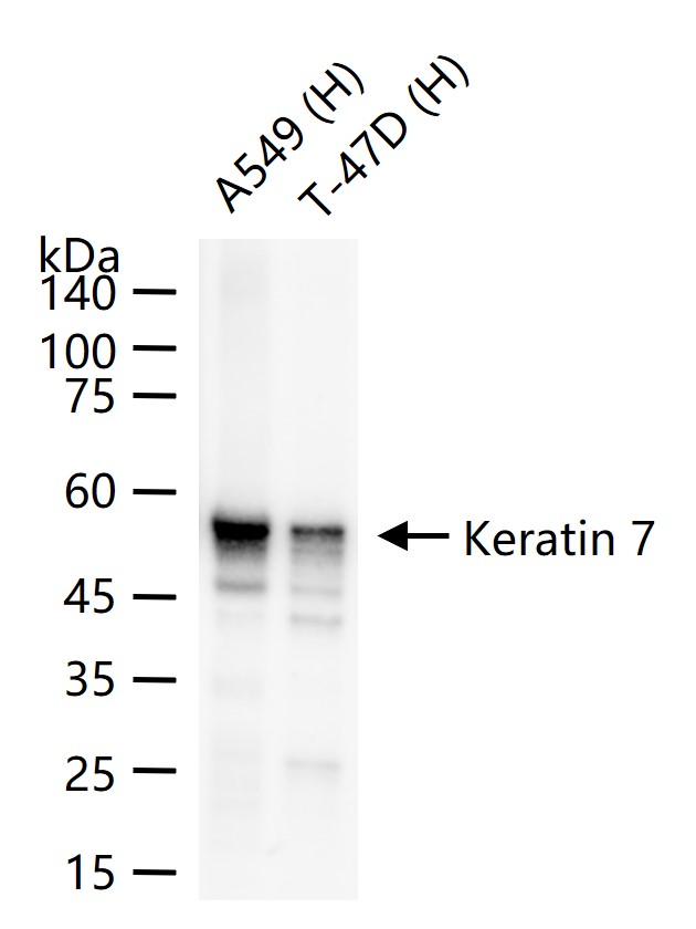 1 - Keratin 7 Recombinant Rabbit mAb AP94677